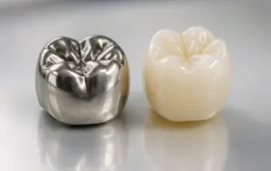 Stainless steel and tooth-colored dental crowns showing two restoration options for children's teeth.