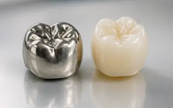 Stainless steel and tooth-colored dental crowns showing two restoration options for children's teeth.